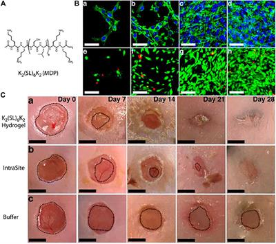 Rational Design of Peptide-based Smart Hydrogels for Therapeutic Applications